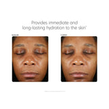 PCA Skin Hyaluronic Acid Boosting Serum | Advanced Hydrating Face Serum 30ml